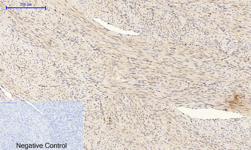 IHC - Bad Polyclonal Antibody AP68618